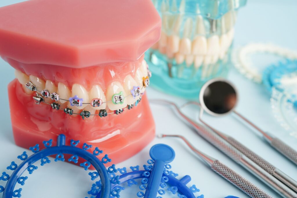 Sample braces with multiple colored bands next to blue bands and dental instruments